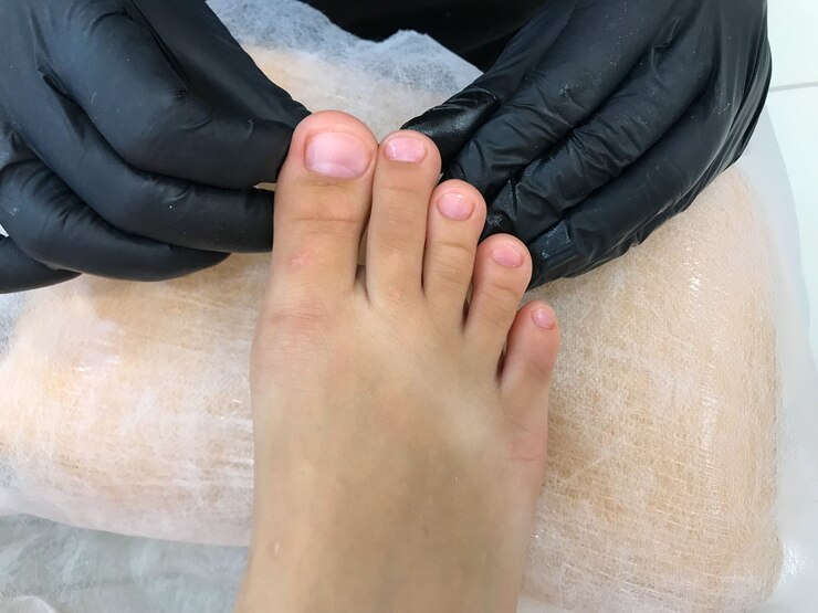 Foot Skin Ailments