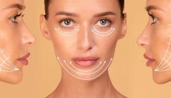 Correction Of Facial Areas With Innotox