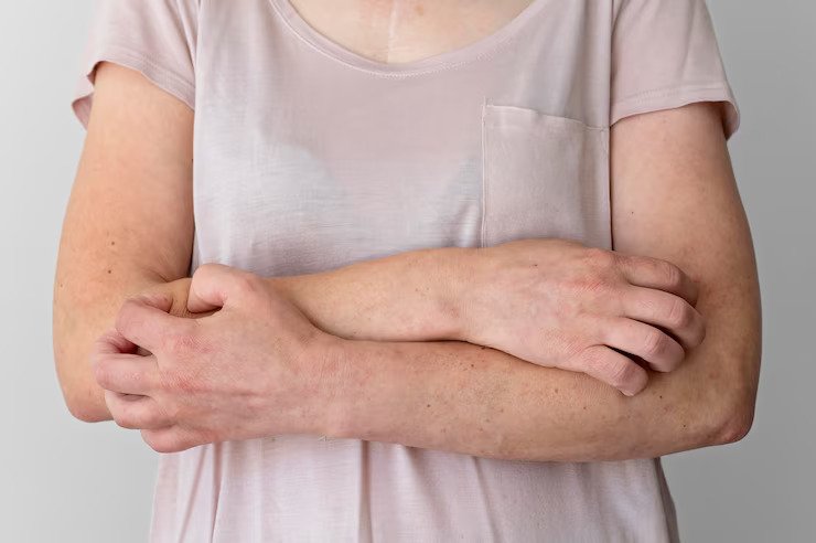 Liver Health Warning Signs Through Skin